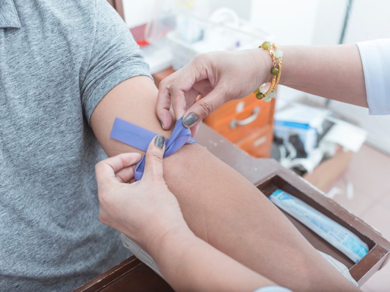 A nurse or phlebotomist tying a rubber IV Tourniquet placed above the elbow. Venipuncture for blood testing or hematology analysis.
